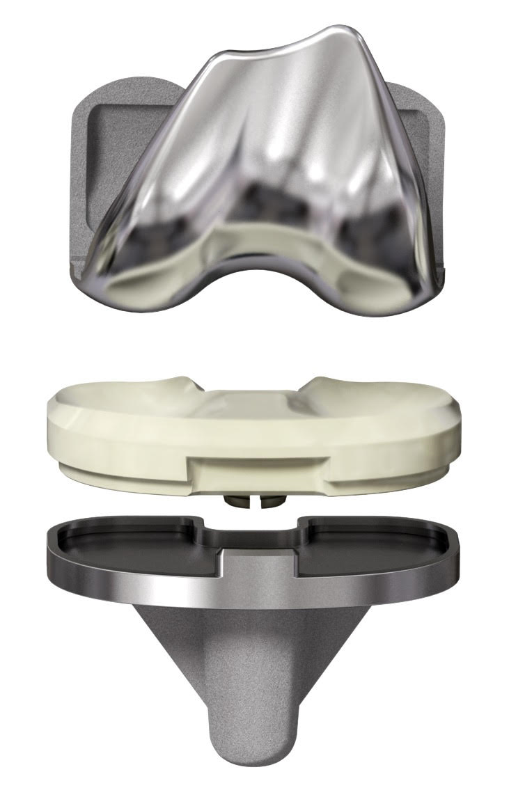 Knee Prosthetic Surgery